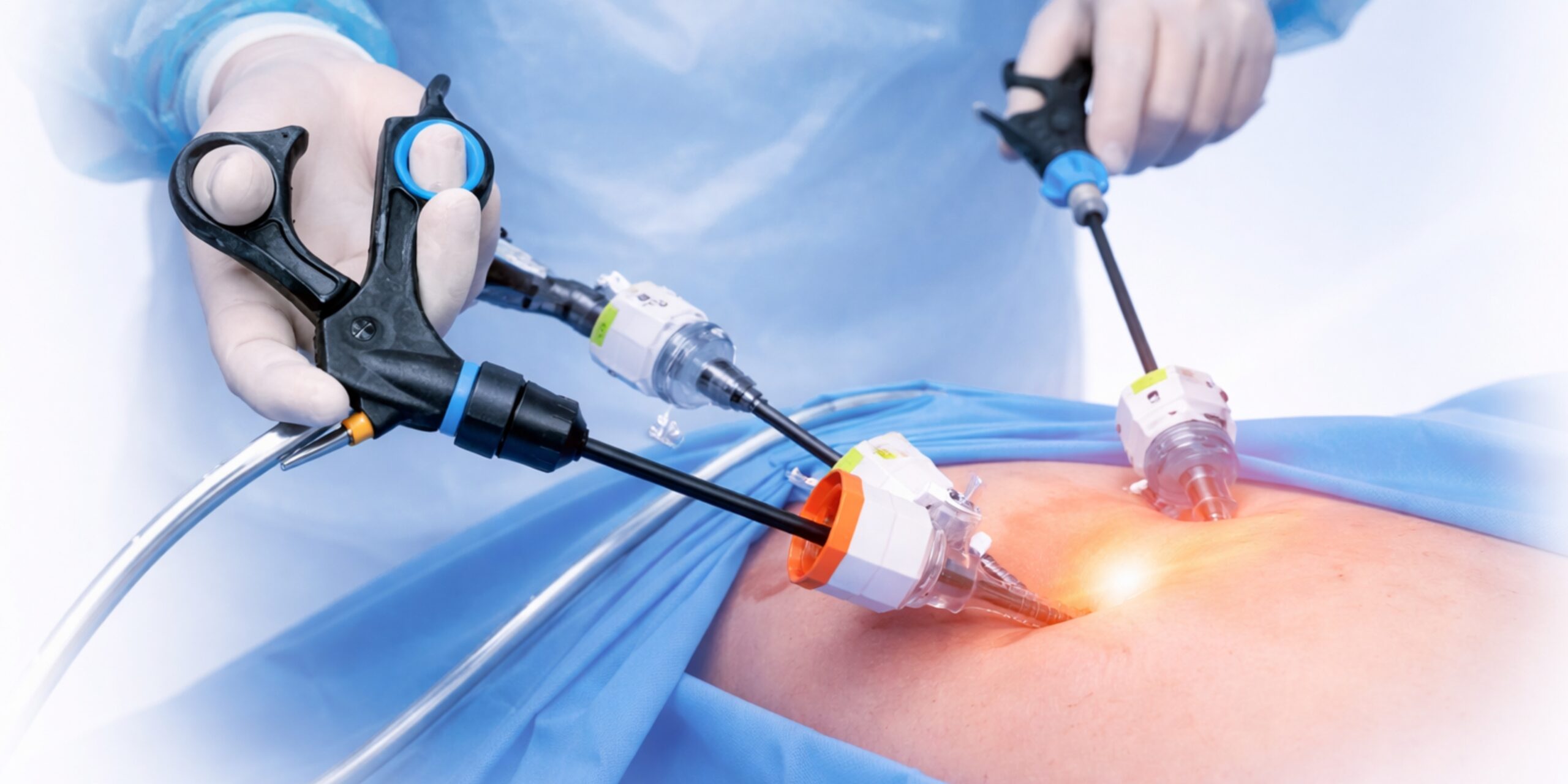 What is Laparoscopic Surgery? Benefits & Procedure Explained